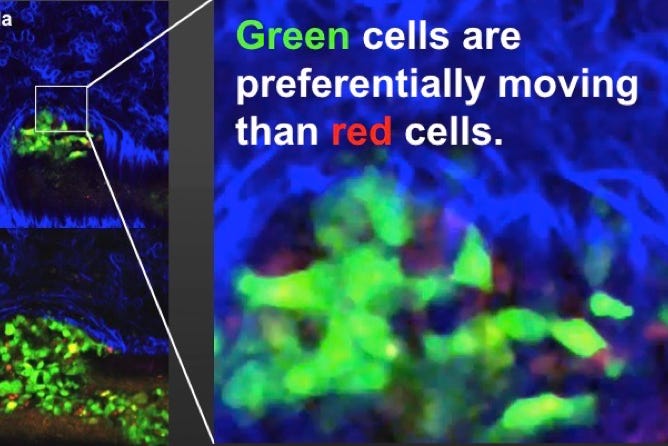 Photo  賀川義規　Yoshinori Kagawa 　大腸がん　手術　消化器外科　皇居　大阪　亀　紅葉　青写真　エクスプレス外来